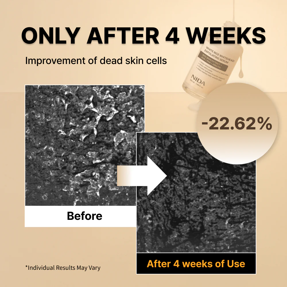 NIDA White Black Exfoliating Serum Duo Bundle - Image 3