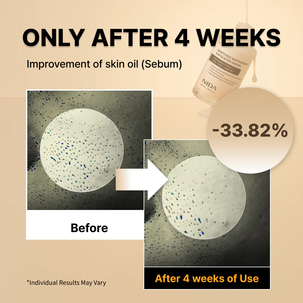 NIDA White Black Exfoliating Serum Duo Bundle - Image 4